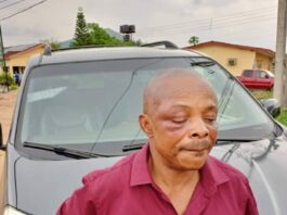 Nigerian Labour Congress President beaten and arrested!