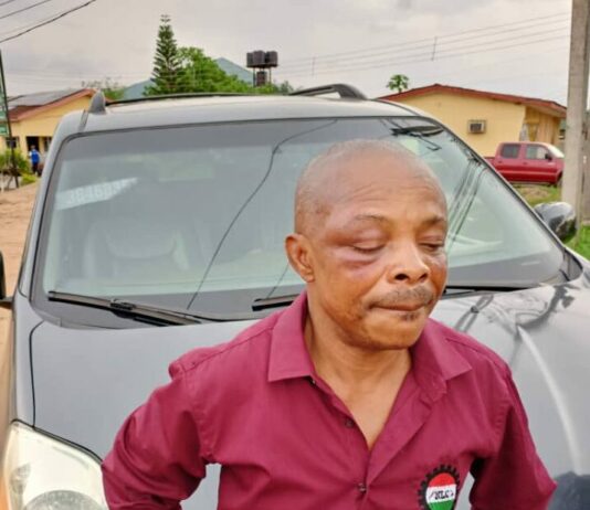 Nigerian Labour Congress President beaten and arrested!